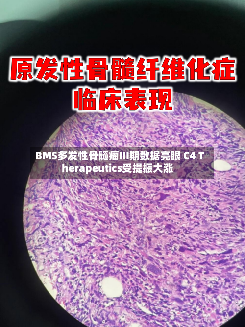 BMS多发性骨髓瘤III期数据亮眼 C4 Therapeutics受提振大涨-第2张图片
